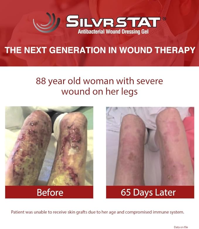 SilvrSTAT First Aid Kit Gel | 32 PPM Silver Healing Wound Dressing Solution | SilverSol Ag₄O₄ Particles | 3 oz